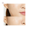 تصویر  چسب ضدجوش کره‌ای COSRX Acne Pimple Master Patch (24 عددی)